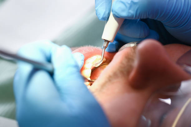 Best Emergency Dental Surgery in Meridian, PA